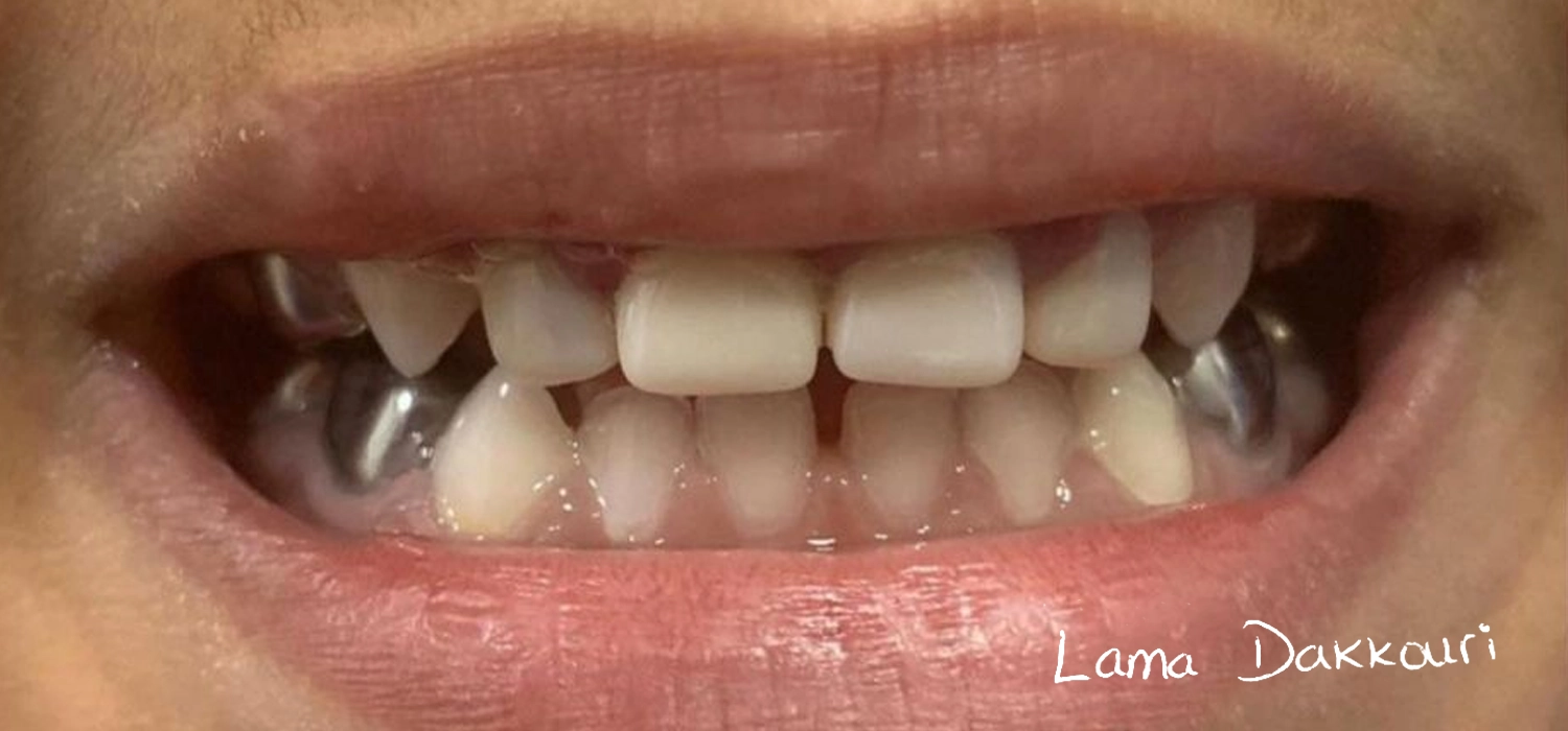 Dr Lama Treatment-02