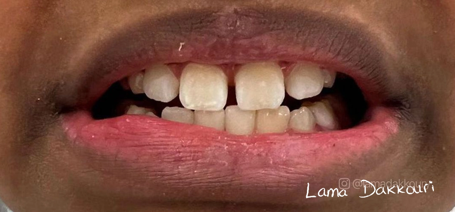 Dr Lama Treatment-04