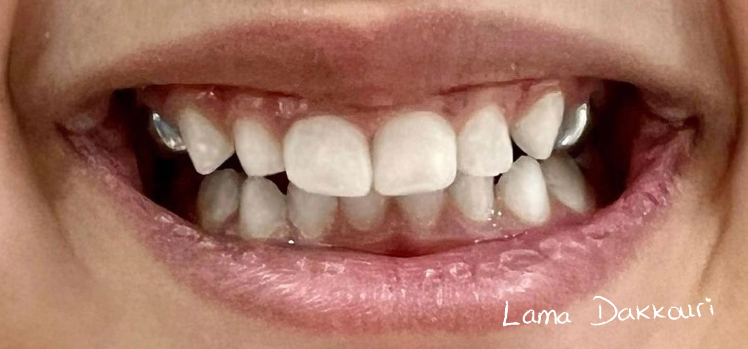 Dr Lama Treatment-06
