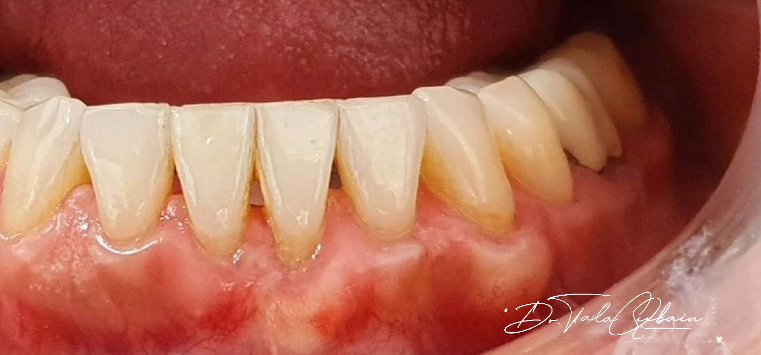 Dr Tala Treatment