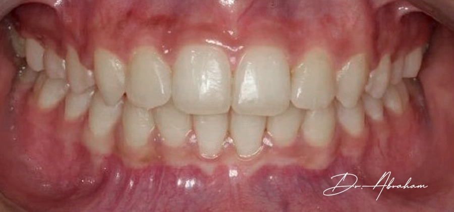 02 Dr Abraham After