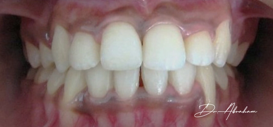 03 Dr Abraham After