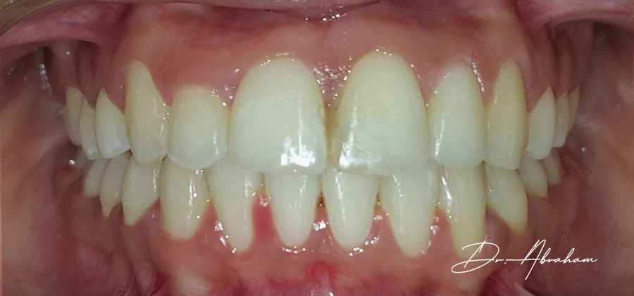 Dr Abraham After
