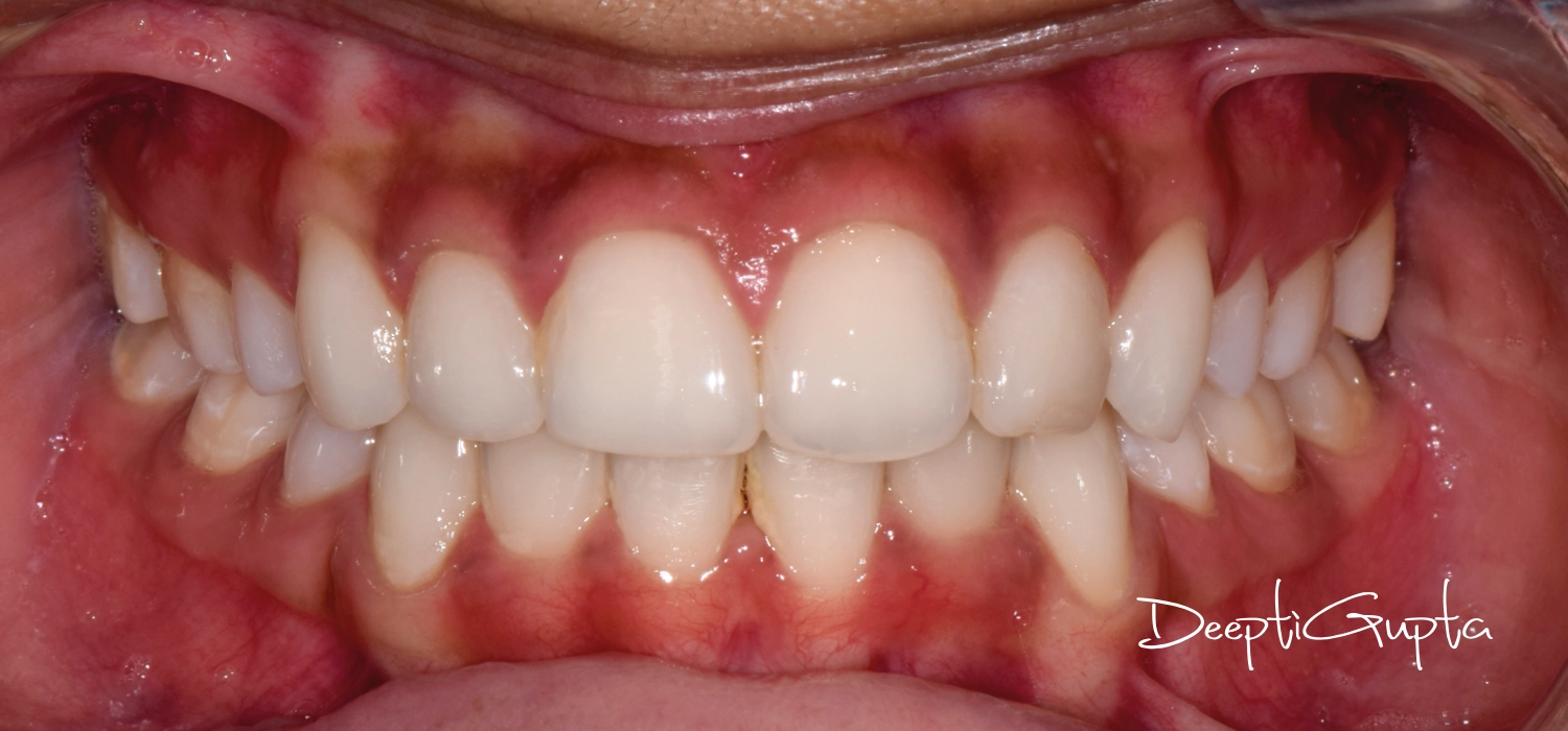 Dr Deepti-04
