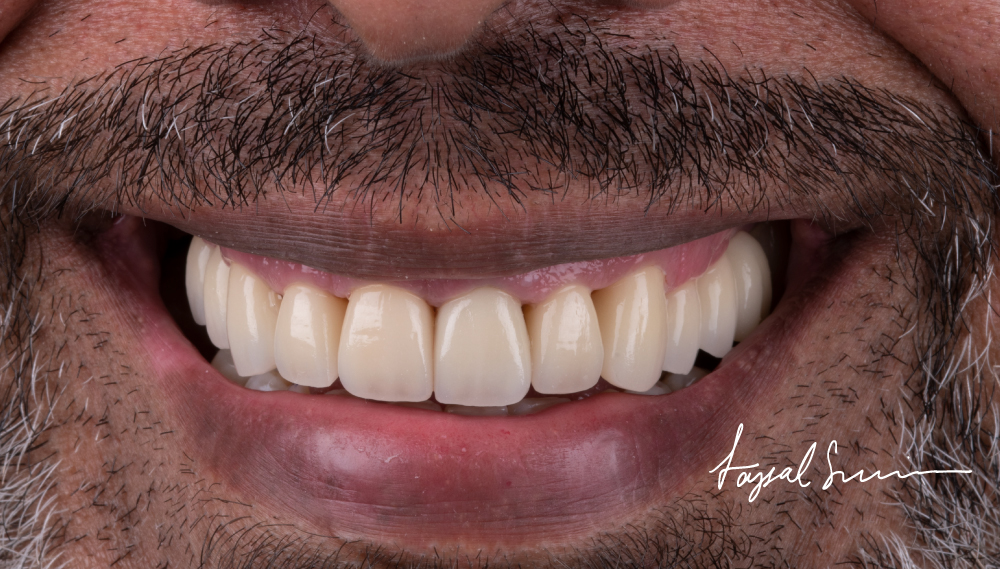 Dr-Faysal-Treatment-00992