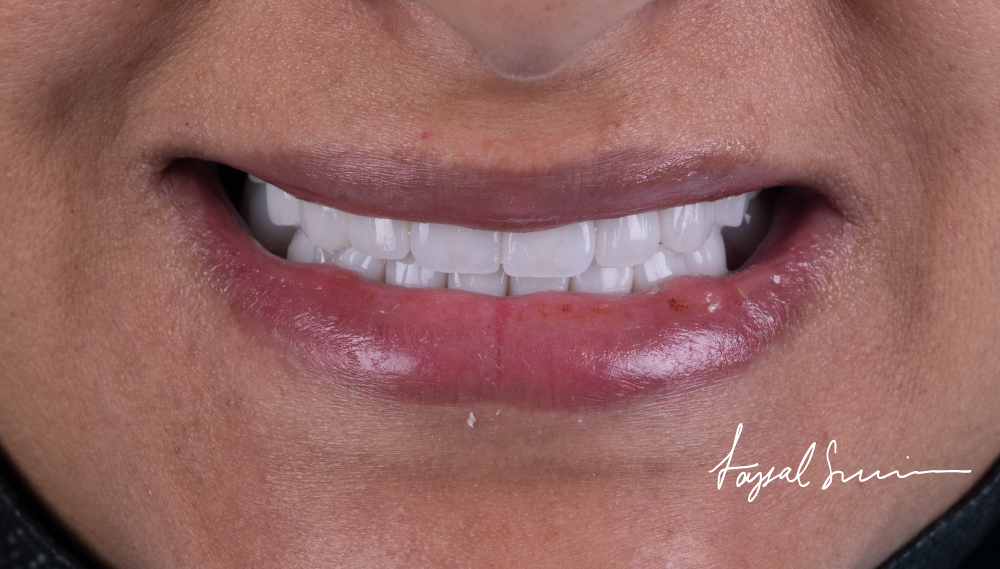 Dr-Faysal-Treatment-00993