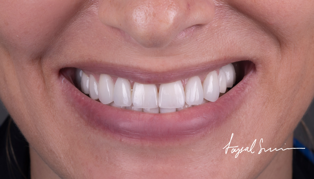 Dr-Faysal-Treatment-00996
