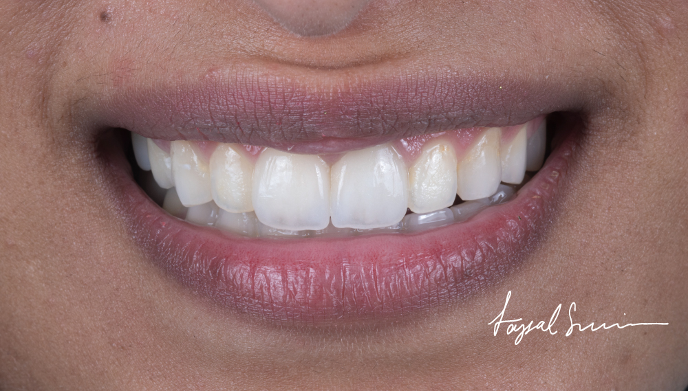 Dr-Faysal-Treatment-00998