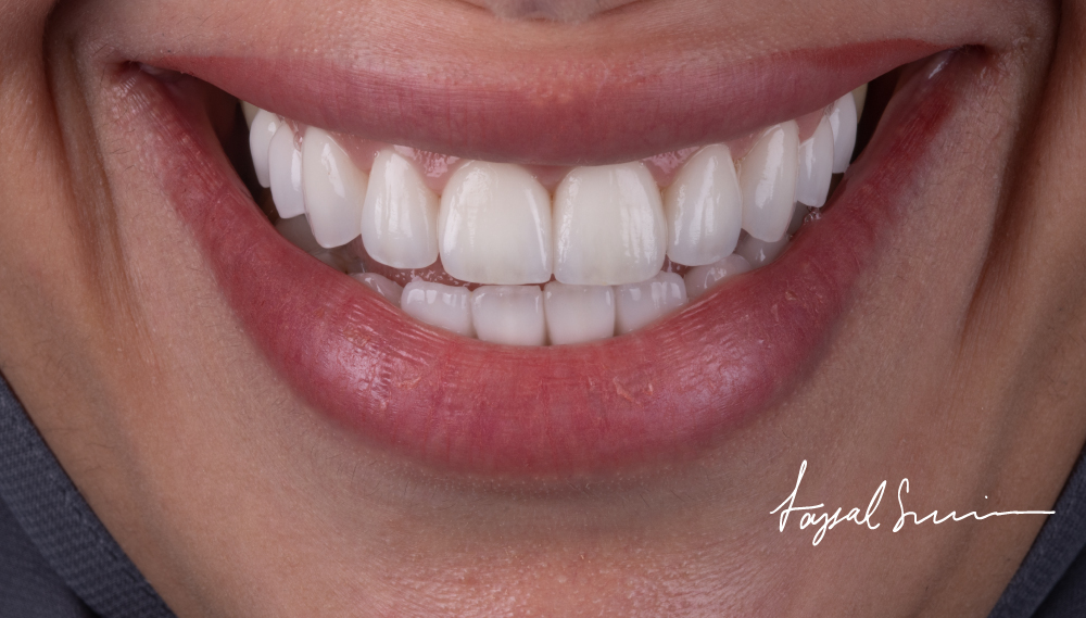 Dr-Faysal-Treatment-01002