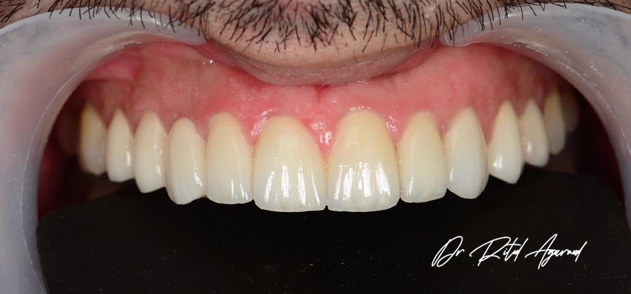 Dr Ritul-Cosmetic Dental Treatment-04