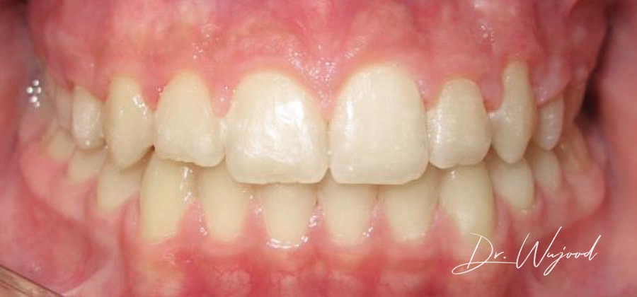 Dr Wuj After