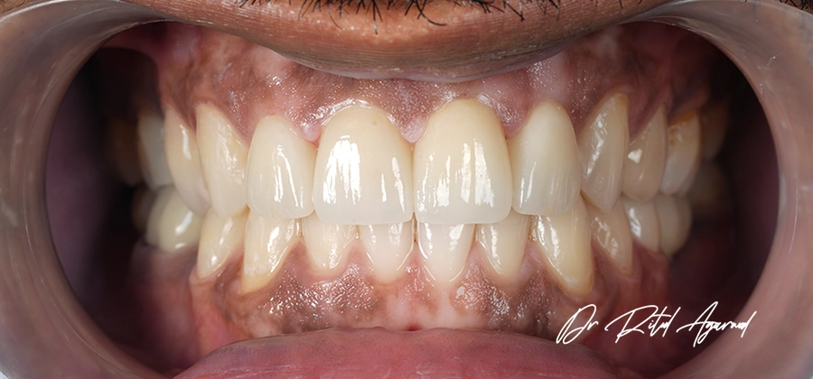 Dr Ritul-Cosmetic Dental Treatment-02